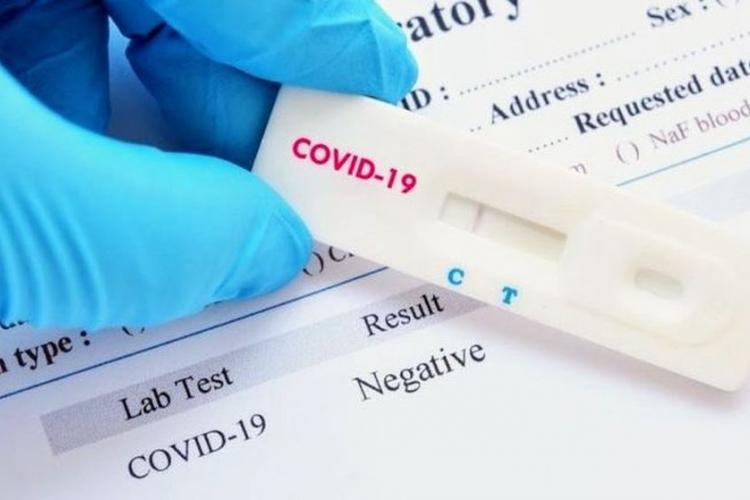 εργαζόμενοι, rapid test, υποχρεωτικό