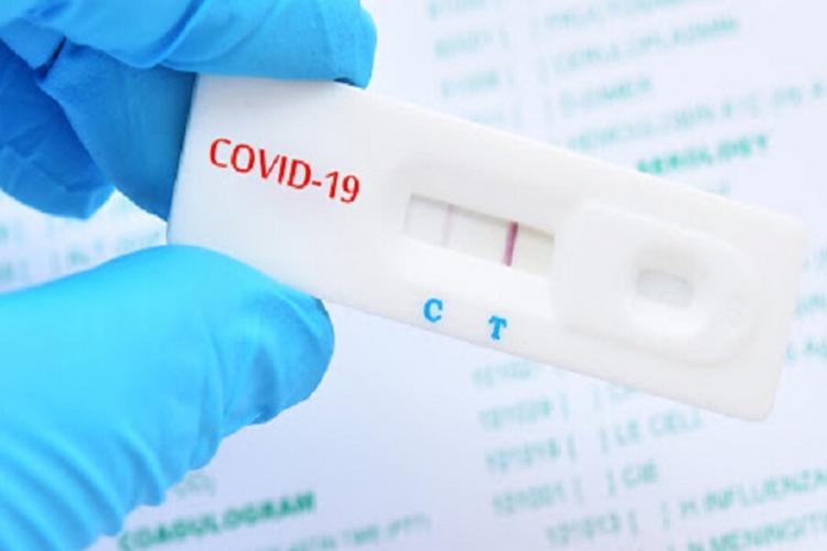 test, Covid-19, κορωνοιός