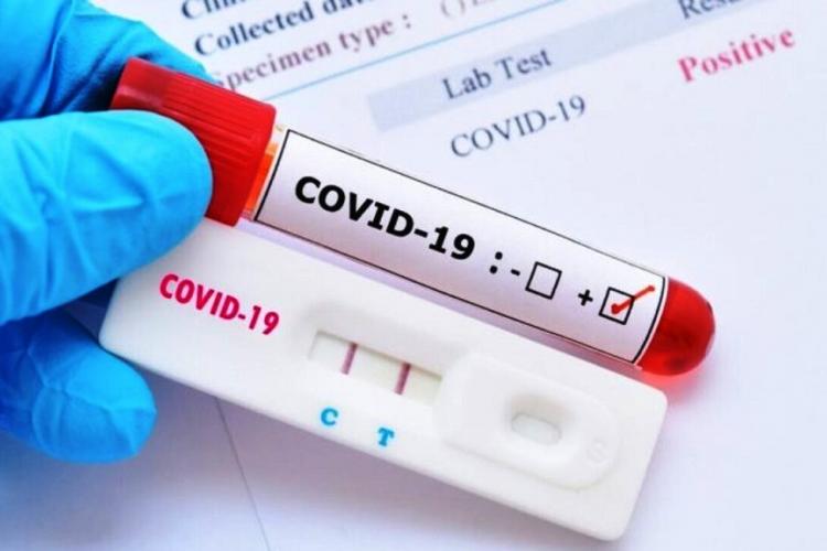 Δωρεάν Rapid Tests στο Δημαρχείο Περιστερίου